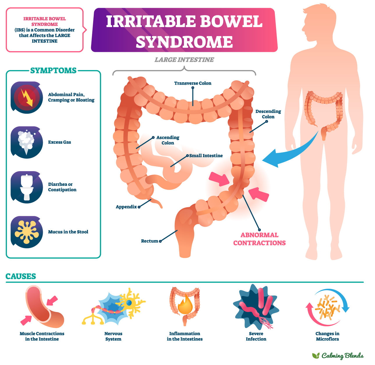 Irritable-Bowel-Syndrome-Diagram